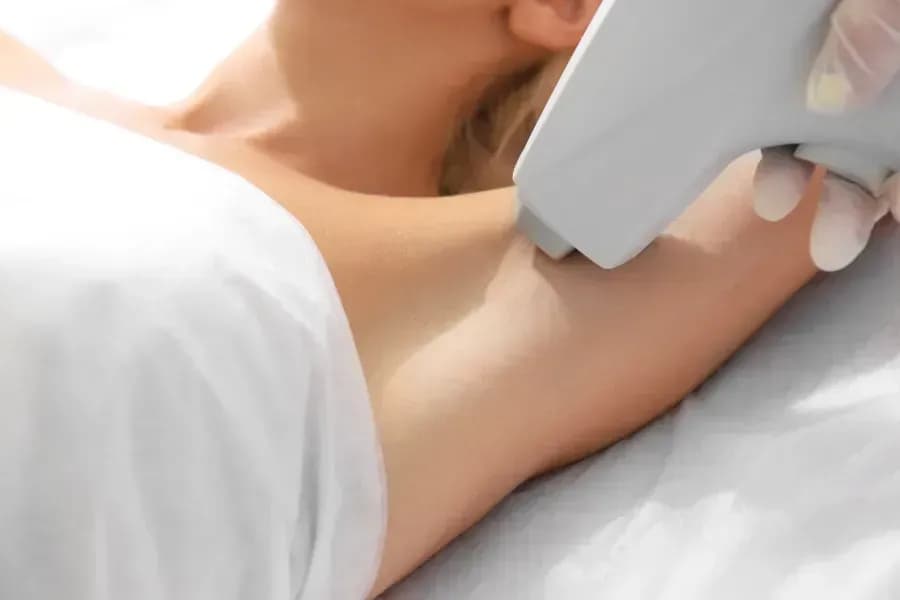 Dauerhafte Haarfreiheit durch Diodenlaser – der richtige Zeitpunkt für die Behandlung