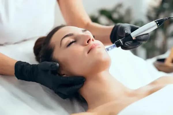 Mit Microneedling Narben und Falten behandeln lassen